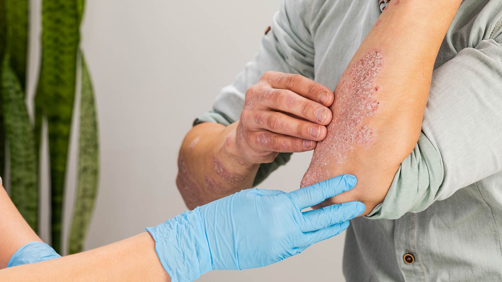 Odczulanie i leczenie alergii biorezonansem