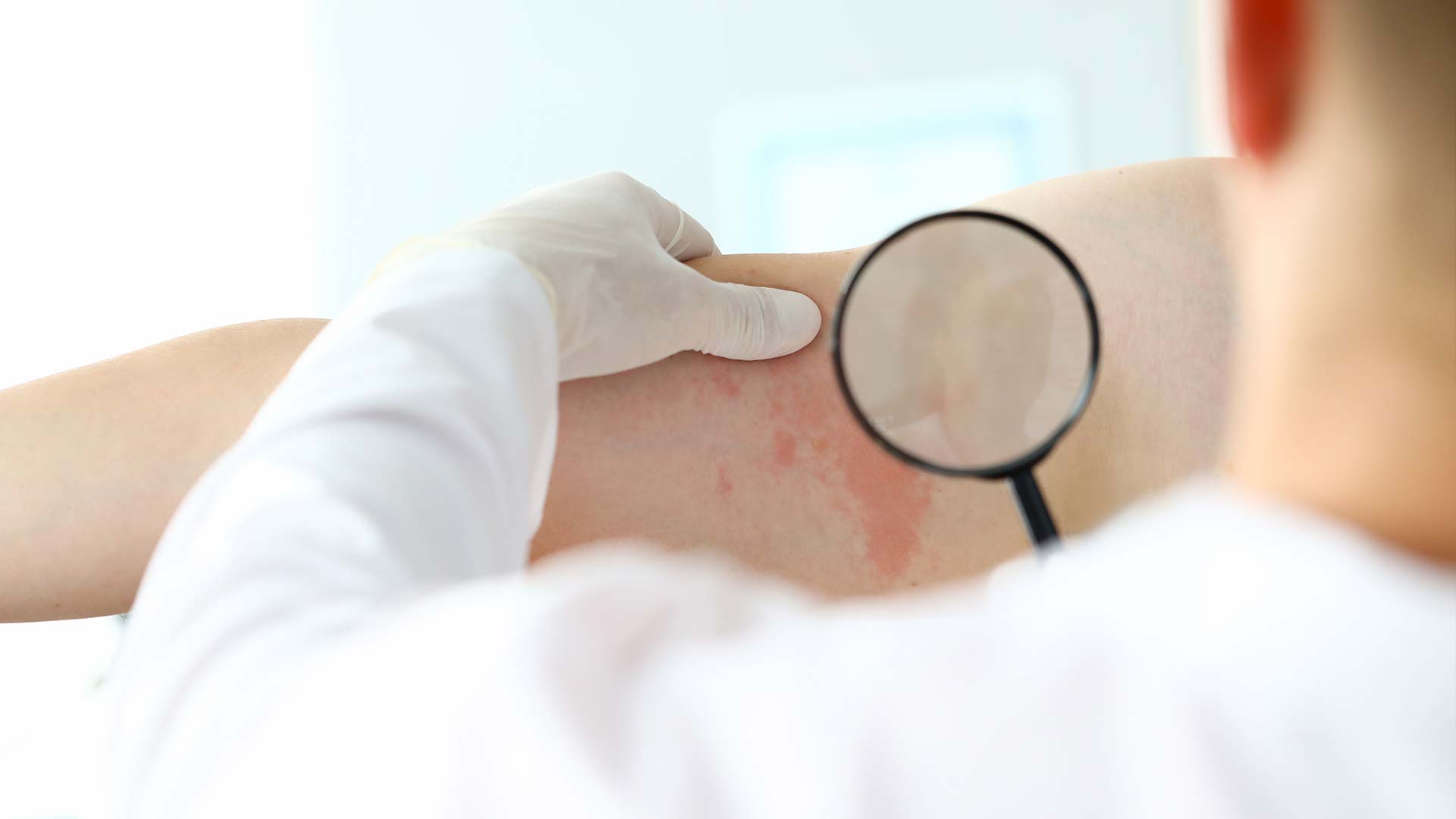 Leczenie boreliozy biorezonansem